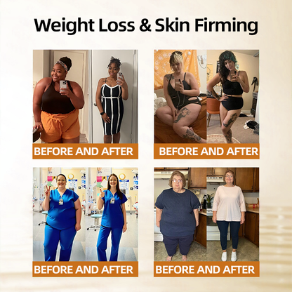 𝑶𝒇𝒇𝒊𝒄𝒊𝒂𝒍 𝑺𝒕𝒐𝒓𝒆  | 👩‍⚕️ 𝐇𝐞𝐚𝐥𝐫𝐢𝐳𝐞®𝐌𝐨𝐫𝐢𝐧𝐠𝐚 𝐁𝐞𝐫𝐛𝐞𝐫𝐢𝐧𝐞 𝟏𝟎-𝐢𝐧-𝟏 𝐌𝐢𝐜𝐫𝐨𝐠𝐫𝐚𝐧𝐮𝐥𝐞 𝐁𝐨𝐝𝐲-𝐒𝐡𝐚𝐩𝐢𝐧𝐠 𝐅𝐚𝐭-𝐁𝐮𝐫𝐧𝐢𝐧𝐠 𝐏𝐚𝐭𝐜𝐡(𝐎𝐧𝐜𝐞 𝐃𝐚𝐢𝐥𝐲, 𝐯𝐢𝐬𝐢𝐛𝐥𝐞 𝐜𝐡𝐚𝐧𝐠𝐞𝐬 𝐢𝐧 𝟕 𝐝𝐚𝐲𝐬）𝟓𝐗 𝐒𝐰𝐞𝐚𝐭 𝐏𝐫𝐨𝐝𝐮𝐜𝐭𝐢𝐨𝐧. 𝐅𝐨𝐫 𝐎𝐛𝐞𝐬𝐢𝐭𝐲, 𝐋𝐨𝐨𝐬𝐞 𝐒𝐤𝐢𝐧, 𝐃𝐢𝐚𝐛𝐞𝐭𝐞𝐬, 𝐒𝐥𝐞𝐞𝐩 𝐀𝐩𝐧𝐞𝐚, 𝐀𝐧𝐝 𝐉𝐨𝐢𝐧𝐭 𝐈𝐬𝐬𝐮𝐞𝐬🎁