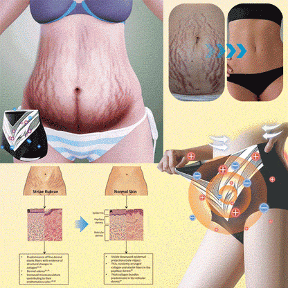 EXPECTSKY®Medical Grade Titanium Fiber Tourmaline Shaping Shorts👙