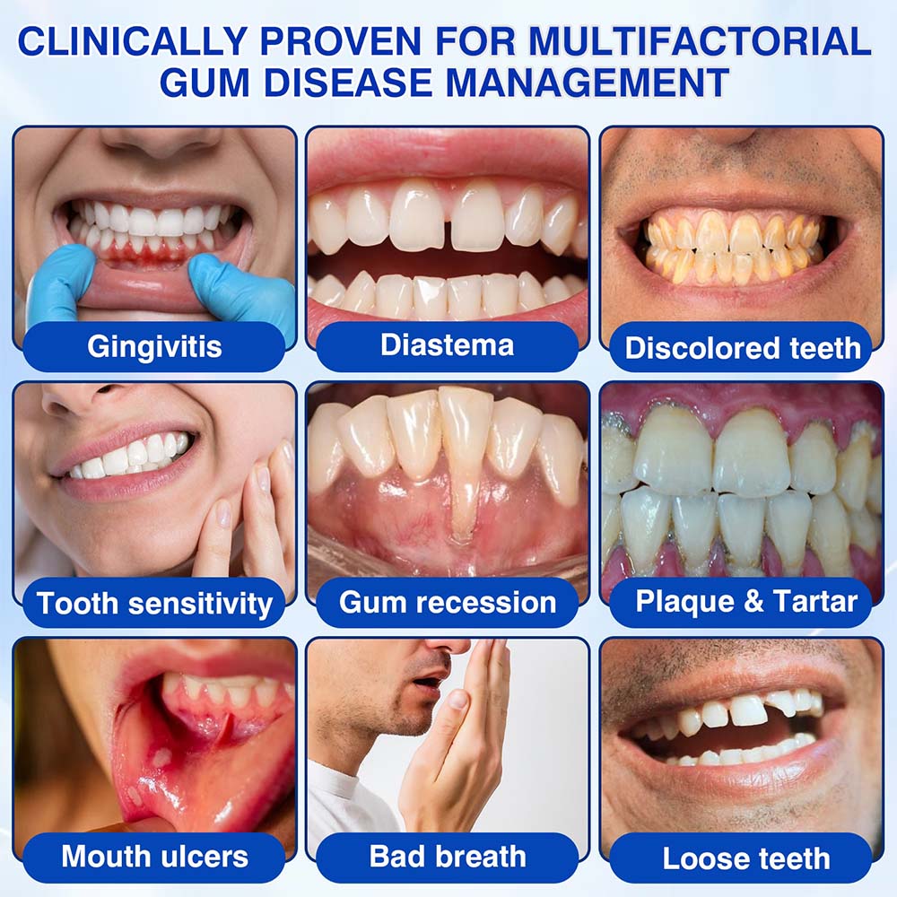 🧑‍⚕️Healrize® GumRevive gel for the regeneration of the tooth-supporting apparatus (for bleeding gums, receding gums, and loose teeth) 🦷