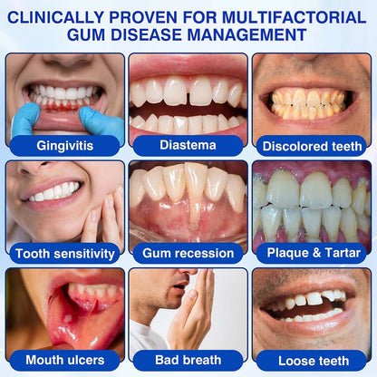 🧑‍⚕️Healrize® GumRevive gel for the regeneration of the tooth-supporting apparatus (for bleeding gums, receding gums, and loose teeth) 🦷
