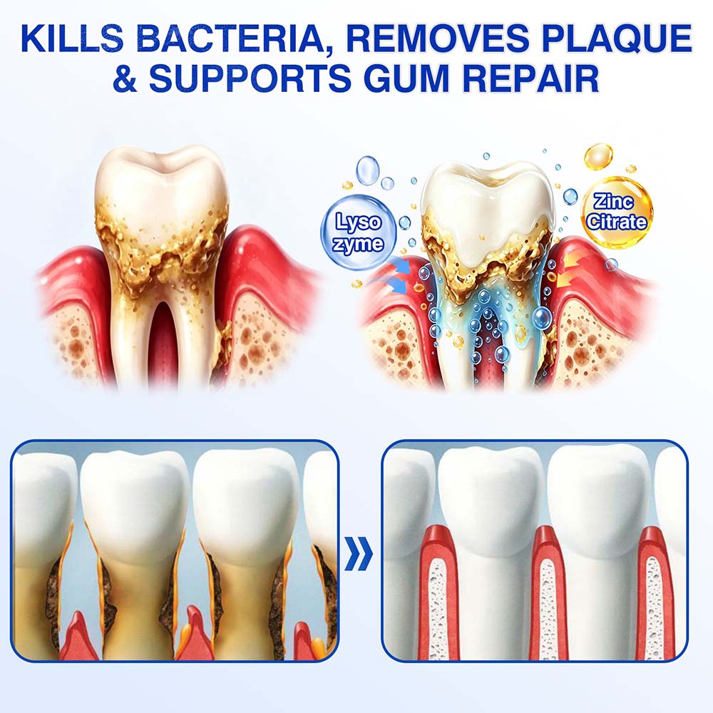 🧑‍⚕️Healrize® GumRevive gel for the regeneration of the tooth-supporting apparatus (for bleeding gums, receding gums, and loose teeth) 🦷