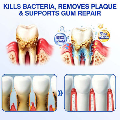 🧑‍⚕️Healrize® GumRevive gel for the regeneration of the tooth-supporting apparatus (for bleeding gums, receding gums, and loose teeth) 🦷