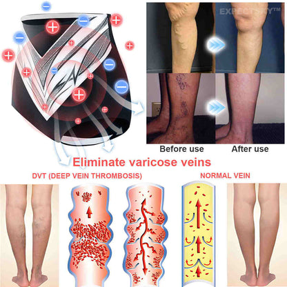 EXPECTSKY®Medical Grade Titanium Fiber Tourmaline Shaping Shorts👙