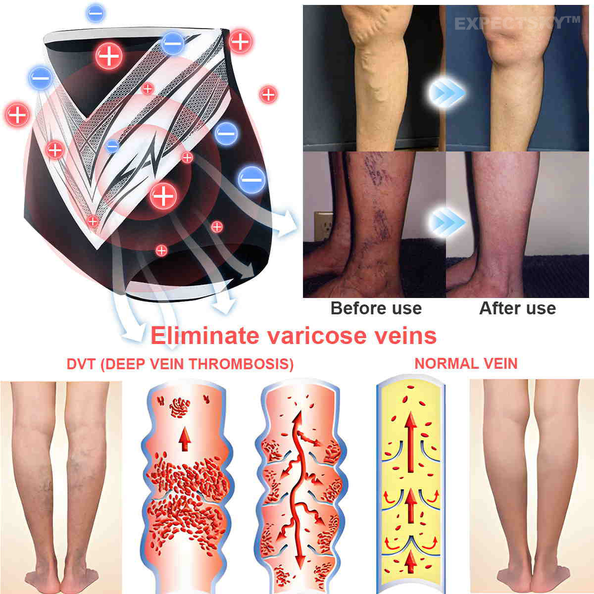 EXPECTSKY®Medical Grade Titanium Fiber Tourmaline Shaping Shorts🎁