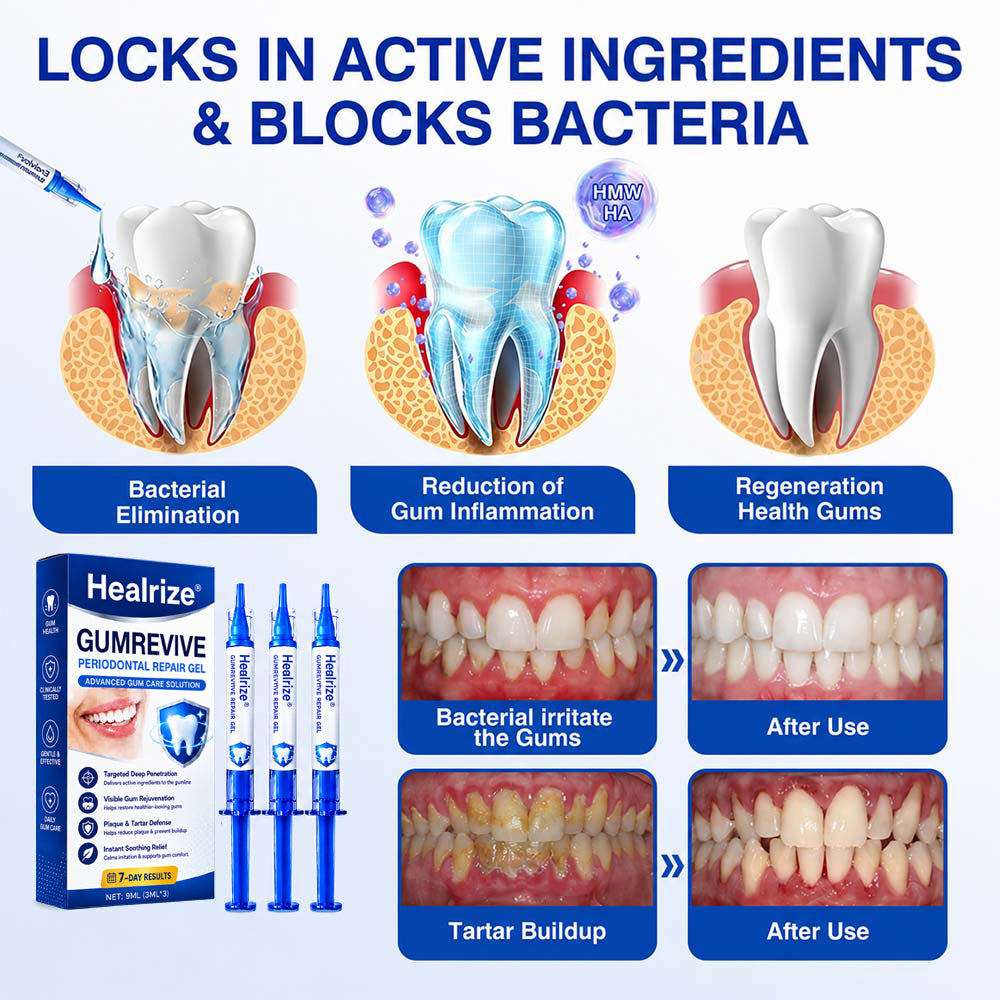 🧑‍⚕️Healrize® GumRevive gel for the regeneration of the tooth-supporting apparatus (for bleeding gums, receding gums, and loose teeth) 🦷
